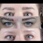 Micro Brow Implant Nedir? 