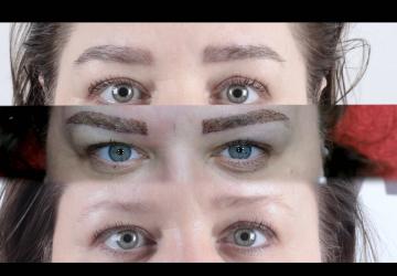 Micro Brow Implant Nedir? 