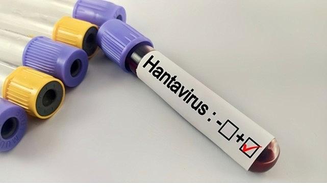 Hantavirüs Bir Salgına Dönüşür mü?